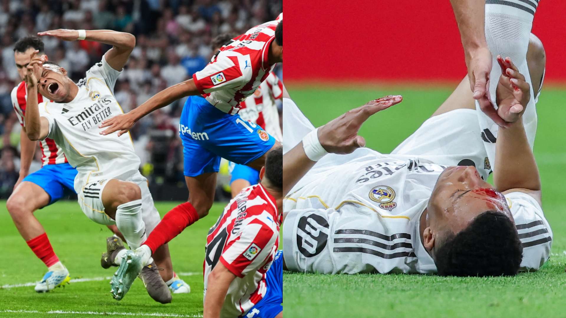 Mbappé Denied: Referee Sparks Controversy in Real Madrid vs Girona