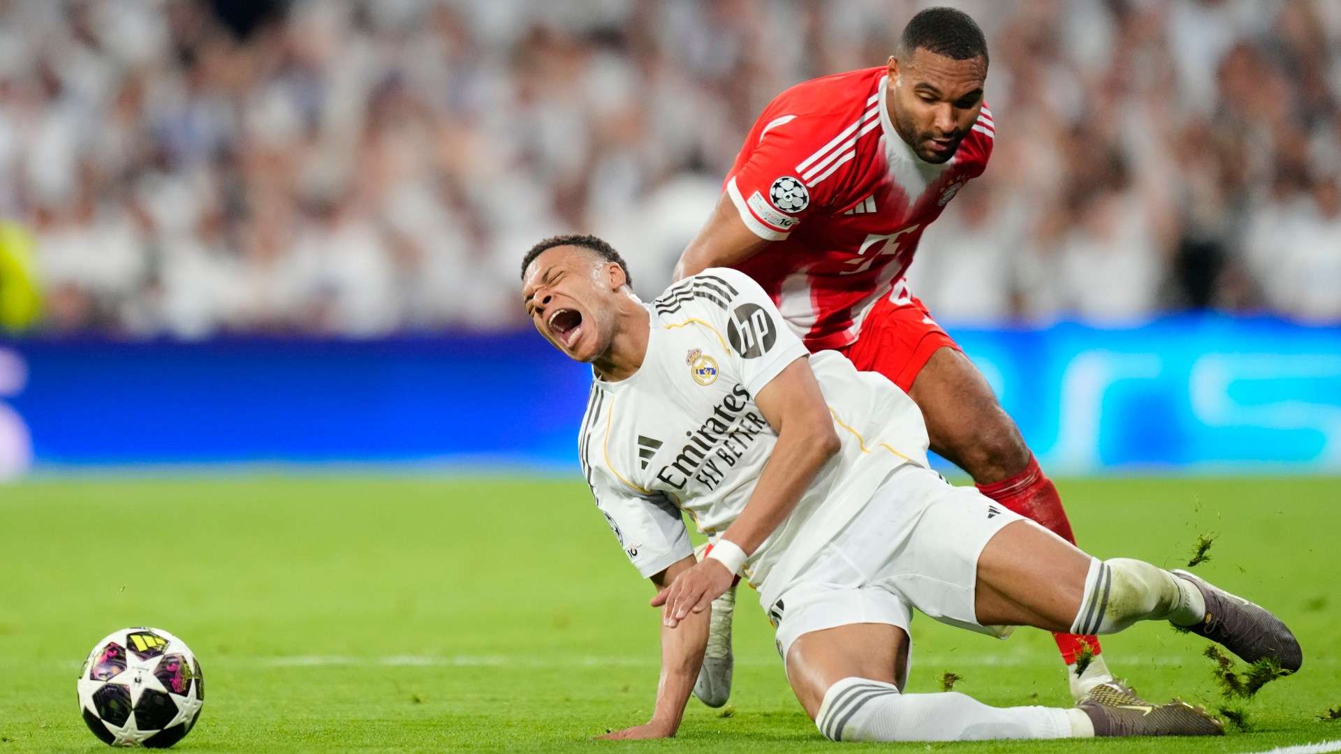 Mbappe Suffers Nasty Gash in Leg After Tah Tackle in Champions League